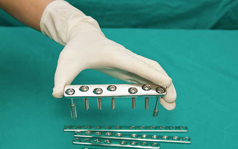 Implant Formulary Development