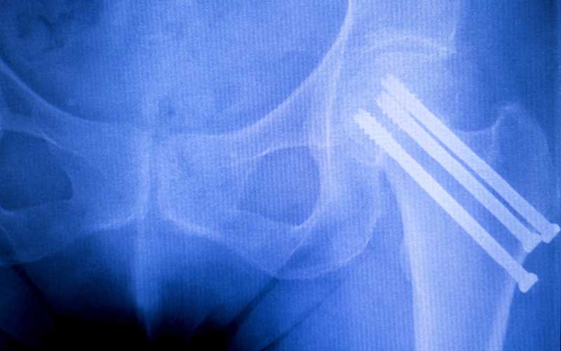 What we do Validating what is implanted